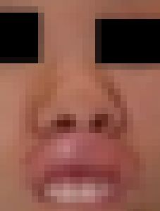 プレミア★ノーズＸＸ　崩しきって私も興奮します激顔編　サンプル画像2