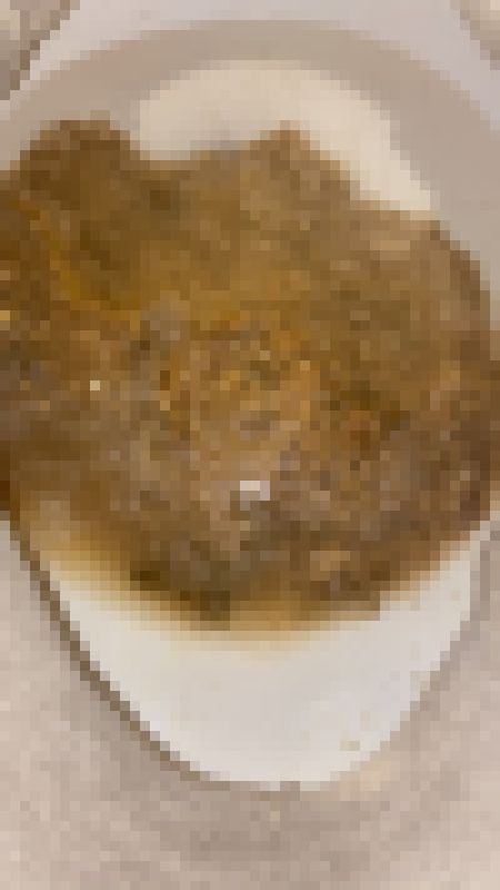 【苦痛】逃れられない苦しみと快感。音声あり サンプル画像