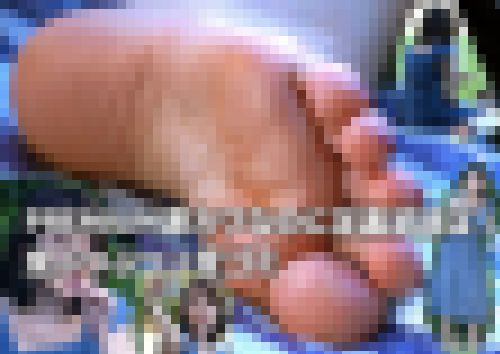 PREMIUM激カワなのに足裏足紋は皮ぷつぷつ＋変ゴミ　サンプル画像2