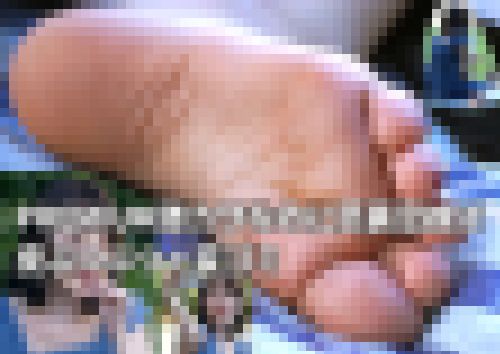 PREMIUM激カワなのに足裏足紋は皮ぷつぷつ＋変ゴミ　サンプル画像3