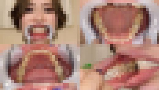 【歯フェチ】ERINAちゃんの歯を観察しました！　サンプル画像1