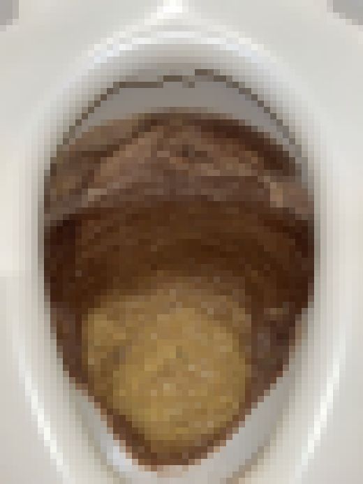 【ドロドロ】お餅吐いたら胃液でクリーム状になった！音声あり　サンプル画像1