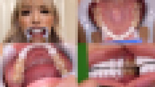 【歯フェチ】霜月るなちゃんの歯を観察しました！　サンプル画像1