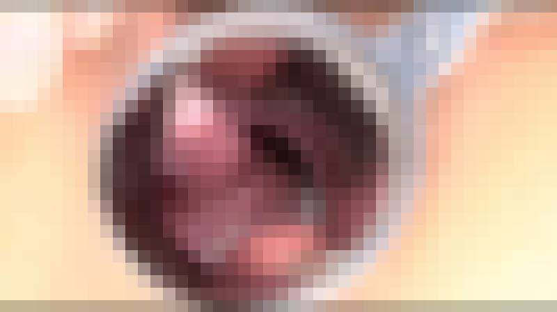 【FetishJapan】子宮 #038 SFJ5-046-17 サンプル画像