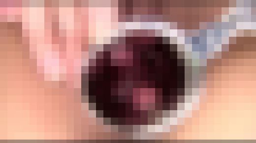 【FetishJapan】子宮 #038 SFJ5-046-17　サンプル画像3