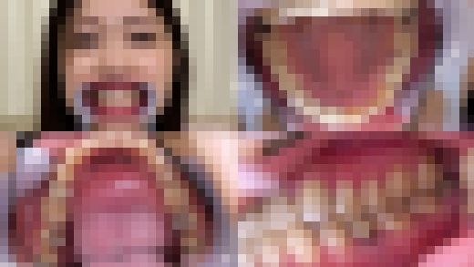 【歯フェチ】野咲美桜さんの歯を観察しました！　サンプル画像1