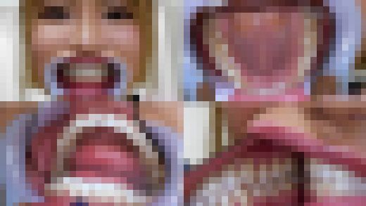 【歯フェチ】月妃さらちゃんの歯を観察しました！　サンプル画像1