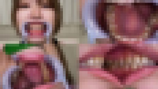【歯フェチ】琴石ゆめるちゃんの歯を観察しました！　サンプル画像1