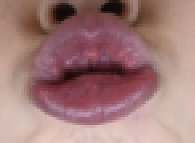 タコチューマニアックNo7～セクシー唇ひなさん～Part① サンプル画像