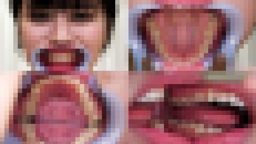 【歯フェチ】紫月ゆかりちゃんの歯を観察しました！　サンプル画像1