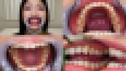 【歯フェチ】滝ゆいなちゃんの歯を観察しました！　サンプル画像1