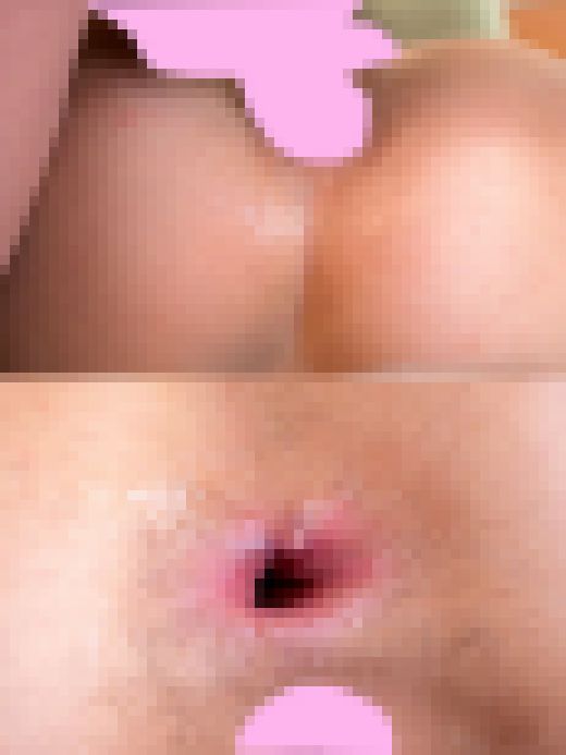 あどけなさの残る童顔ギャルのケツ穴をメリメリ拡張…アナルへディルド捻じ込みぽっかりホール観察・アナルＳＥＸでそのままケツ穴ザーメ　サンプル画像3