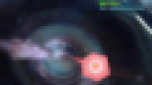 夏休み中のコギャルちゃん中出し性行為の様子を小型カメラで結合部接写＆中出し精液でズルズルの膣内観察　サンプル画像2