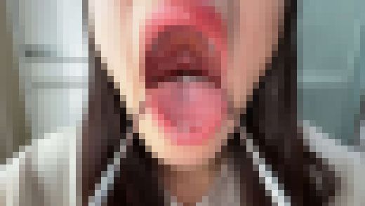 【個人撮影】八森わか菜の舌ブラシで「汚舌苔」採取　サンプル画像2