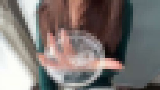 【口内接写】　江戸川もなかの「汚舌苔」採取　　サンプル画像3