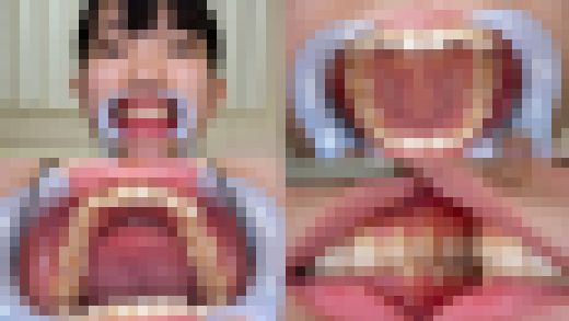 【歯フェチ】伊織ひなのちゃんの歯を観察しました！　サンプル画像1