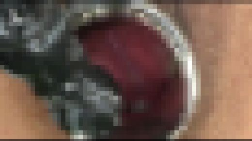 【FetishJapan】子宮 #055 SFJ5-056-04　サンプル画像3