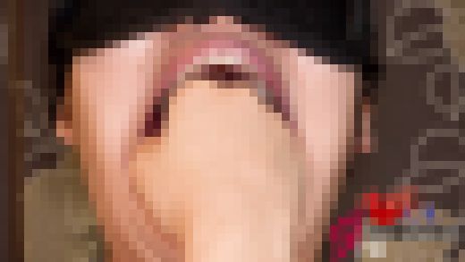 潮吹き変態の夢ちゃん奥歯治療中!?フィストも飲み込む口腔開口器鑑賞　サンプル画像3