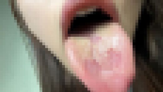 街角で声をかけて口内観察させてもらう 大学生　ゆゆちゃん nko03-1　サンプル画像2