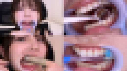 【歯フェチ】特別企画! 河合陽菜ちゃんの歯をデンタルミラーで観察&開口器着けながら歯磨き&口角鉤着けながら指歯ブラシ　サンプル画像1