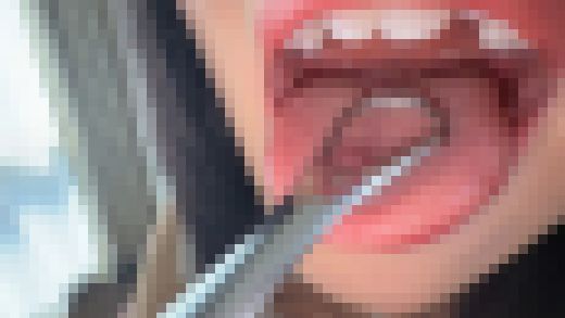 個人撮影】桃瀬まゆの舌ブラシで「汚舌苔」採取　サンプル画像3