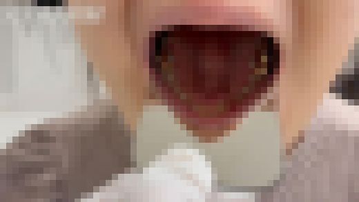 【素人・口腔フェチ】これが見れるのは奇跡です。金歯の20歳を余すとこなく完全収録。　サンプル画像2