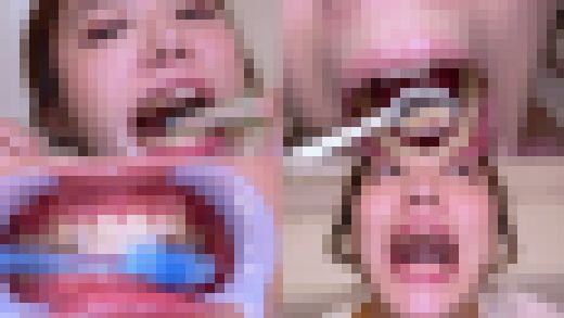 【歯フェチ】特別企画！ 川越ゆいさんの歯をデンタルミラーで観察&開口器着けながら歯磨き&口角鉤着けながら指歯ブラシ　サンプル画像1