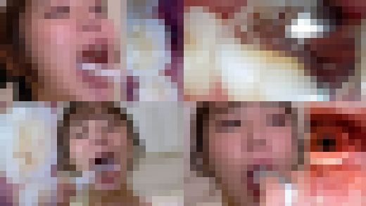 【歯フェチ】特別企画！ 川越ゆいさんの歯・口内・喉奥を歯科用カメラで観察　サンプル画像1