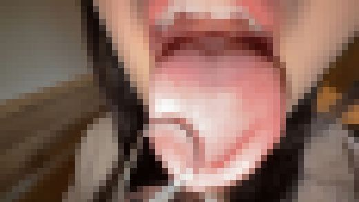 【個人撮影】音羽美鈴の舌ブラシで「汚舌苔」採取　サンプル画像2