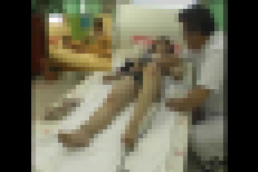 鍼灸院治療　出張マッサージ編 　case.25　サンプル画像1