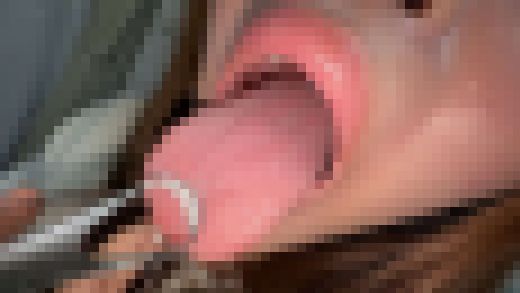 【個人撮影】宮ノ木しゅんかの舌ブラシで「汚舌苔」採取　サンプル画像2