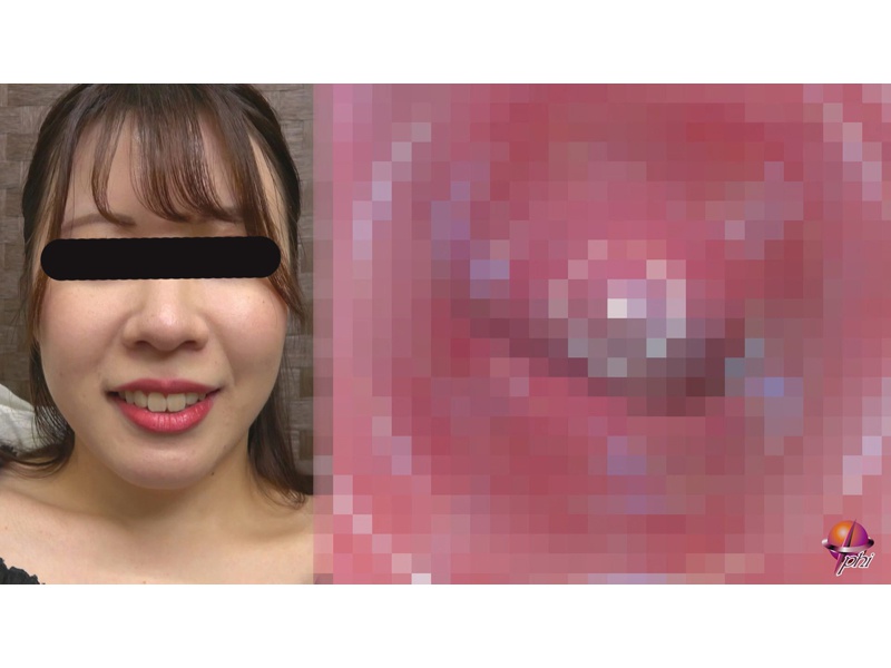 ポルチオ観察開発オナニー　サンプル画像19