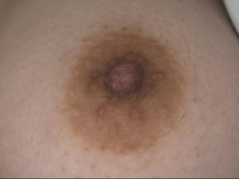 100人の乳首 第8集 　サンプル画像10
