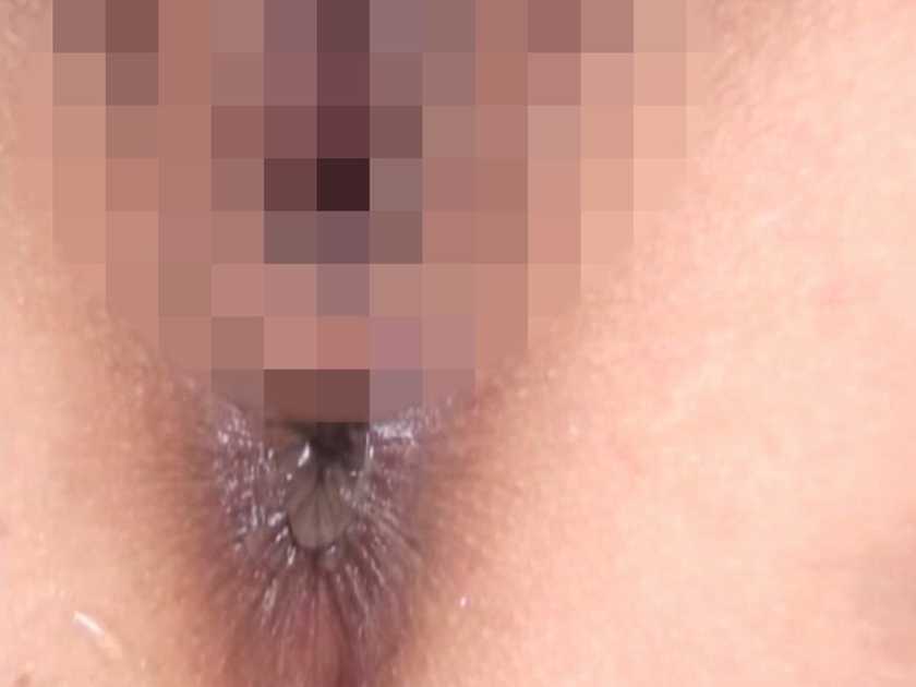 がっつりアナルSEX グリセリン大量浣腸でパックリ開いた菊門 　サンプル画像3