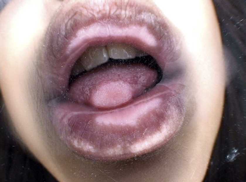 ベロチュウMAX 04 　サンプル画像5