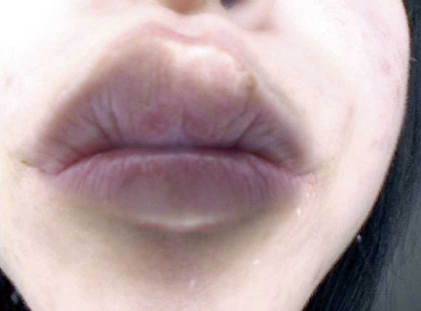 ベロチュウMAX 04 　サンプル画像6