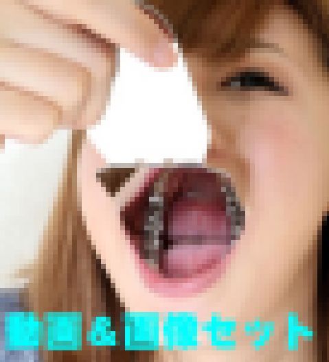 綾子ちゃんの歯★★お得な動画＆画像セット★★インレー脱離後、1年放置！立派なクラウン娘 サンプル画像