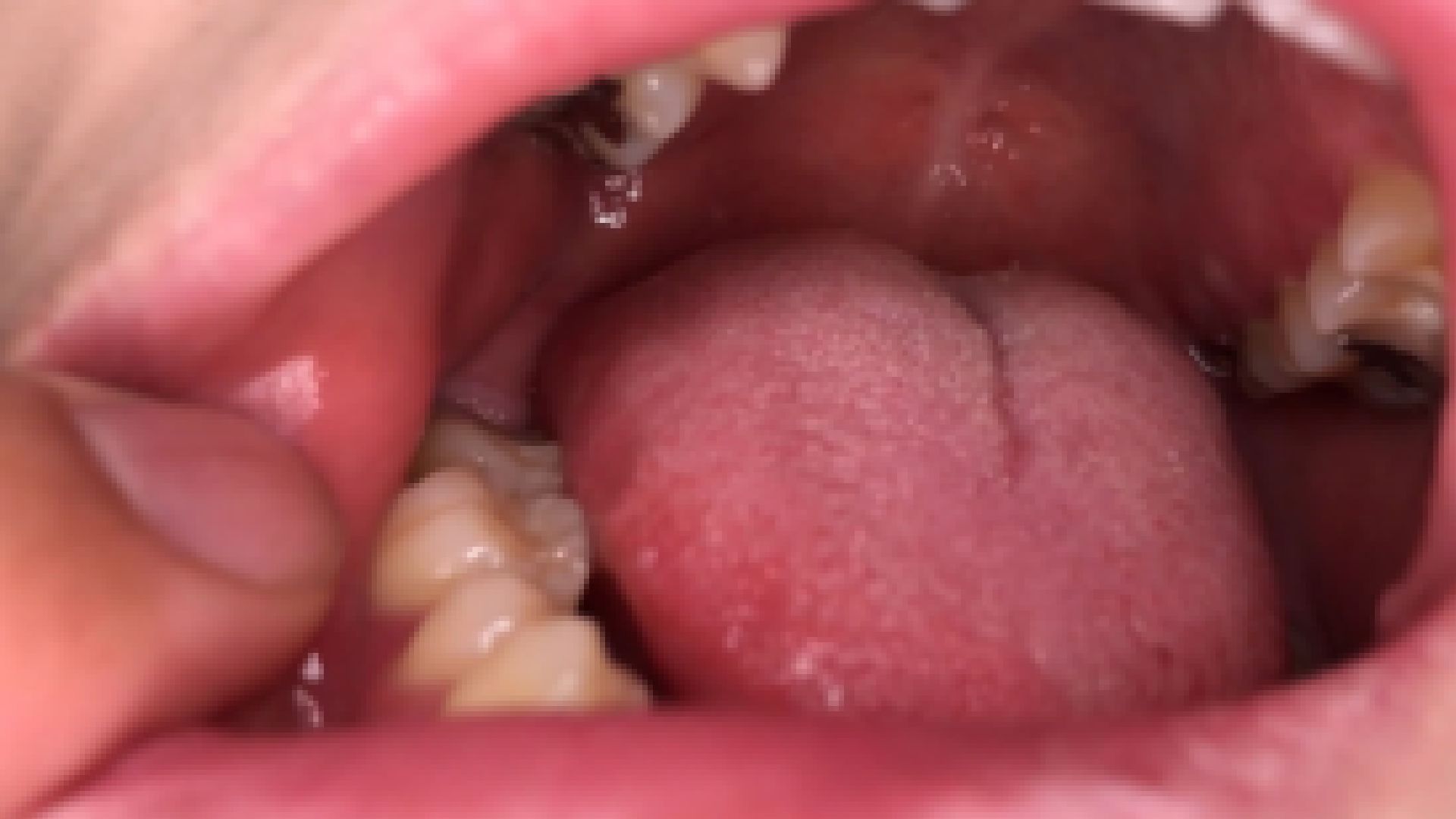 はい、歯科検診の時間です ユイ③ KITR00306 サンプル画像