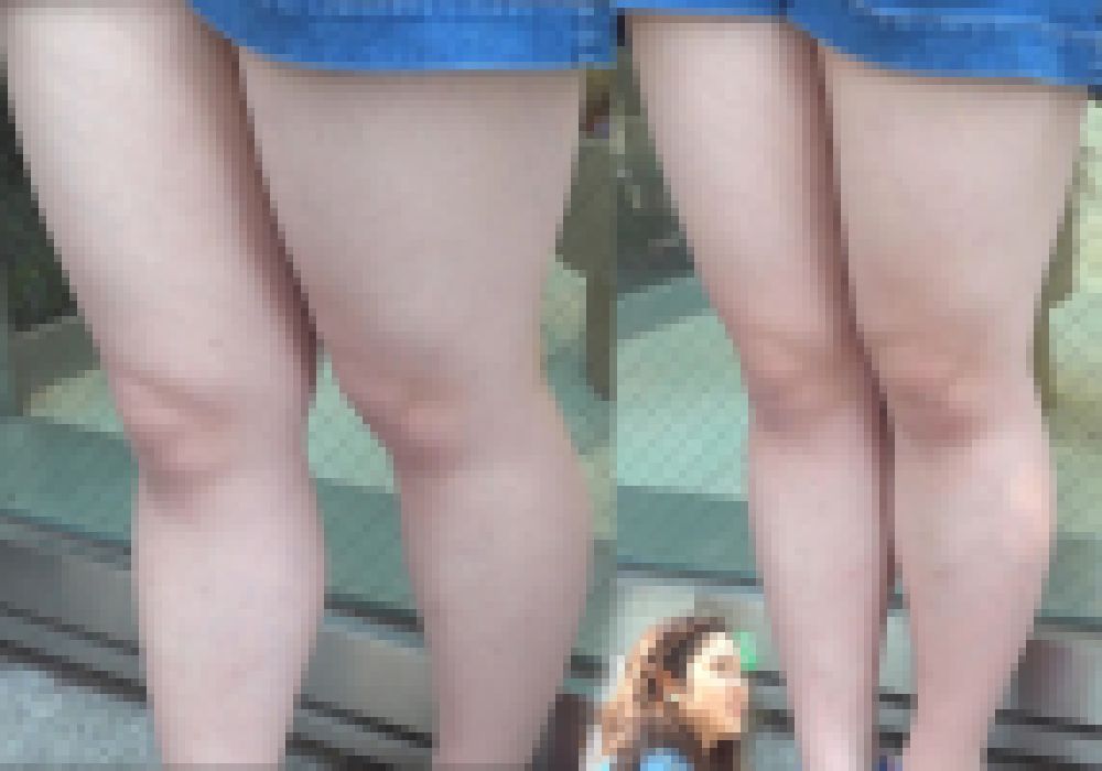 生脚シリーズ№6 丁度いいムッチリ短パン生足！専門学校生を接写したよ！ サンプル画像