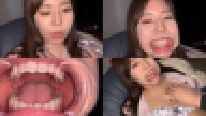 歯姫 28人目 [FBOM-00077] サンプル画像