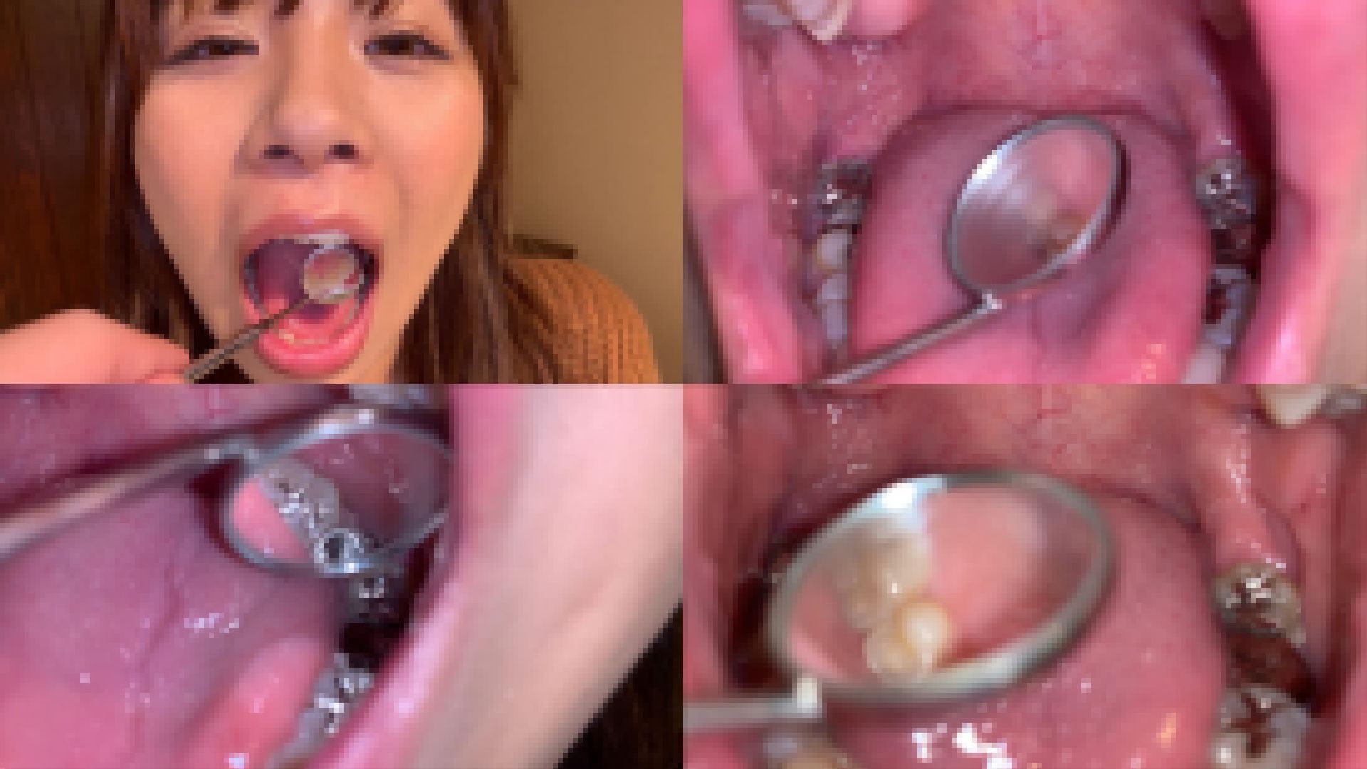 歯姫 48人目 [FBOM-00111] サンプル画像