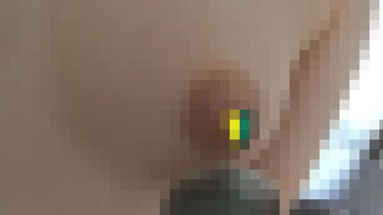 非常勤医師の婦人科診察秘録23「もぎたて果実のボブちゃん。淡桃ピンク乳首が敏感すぎで俯く」 サンプル画像3